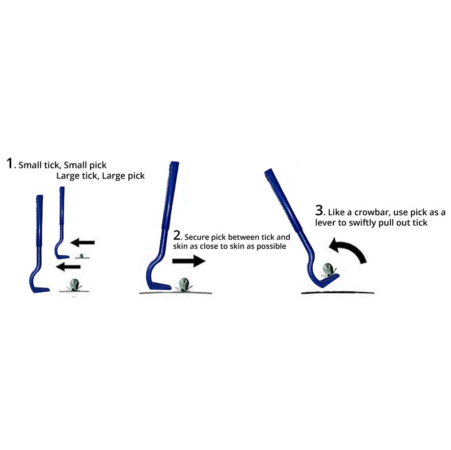 demonstrating how to remove ticks with a tick pick properly.