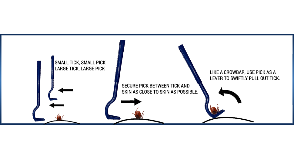 Step-by-step visual guide demonstrating how to use the TickPick® tool for safe tick removal. The diagram shows the selection of the correct pick size, positioning the tool between the tick and skin, and using a crowbar-like motion to lift the tick out cleanly and effectively.