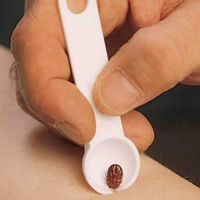 Close-up of a hand using the AtlanTick Tick Scoop Remover to safely remove a tick from the skin. The scoop's notch is positioned close to the skin, securing the tick for easy and effective removal.